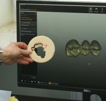 Model 3D zęba (na ekranie) i gotowa korona po wycięciu 