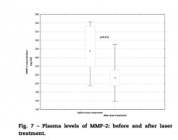 Skojarzona laseroterapia a przerośnięte blizny pooparzeniowe dzieci Skojarzona laseroterapia a przerośnięte blizny pooparzeniowe dzieci