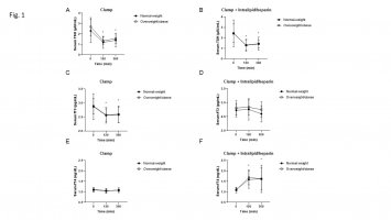 Zespół naukowców z UMB opublikował artykuł “Adipose tissue and skeletal muscle expression of genes associated with thyroid hormone action in obesity and insulin resistance