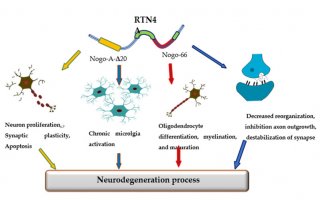 Znaczenie kliniczne białka retikulon 4 (RTN4) w diagnostyce różnicowej chorób neurodegeneracyjnych