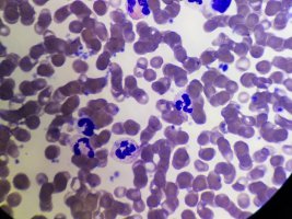 Immunologia po akademicku - konsultacje dla licealistów za nami Immunologia po akademicku - konsultacje dla licealistów za nami