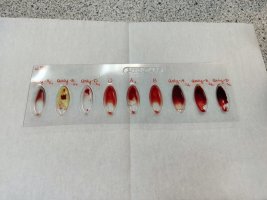 „Oznaczanie grup krwi w układzie ABO i Rh” było tematem warsztatów zrealizowanych w ramach projektu „Biologia i Chemia po akademicku 2” „Oznaczanie grup krwi w układzie ABO i Rh” było tematem warsztatów zrealizowanych w ramach projektu „Biologia i Chemia po akademicku 2”