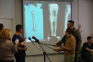 Lekarze z Kliniki Ortopedii, Traumatologii i Chirurgii Ręki USK przeprowadzili operację wymiany dwóch stawów i całej kości udowej