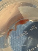 Nowa metoda kriobiopsji płuc na UMB