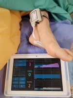 Nowe urządzenia na Oddziale Anestezjologii i Intensywnej Terapii USK