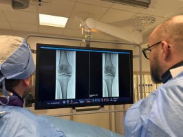 Nowatorska embolizacja kolan w Uniwersyteckim Szpitalu Klinicznym metodą TAME