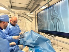 Nowatorska embolizacja kolan w Uniwersyteckim Szpitalu Klinicznym metodą TAME