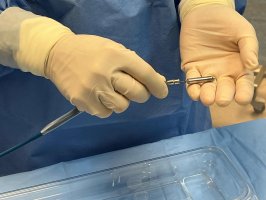 Implantacja bezelektrodowego stymulatora serca nowej generacji w USK Implantacja bezelektrodowego stymulatora serca nowej generacji w USK