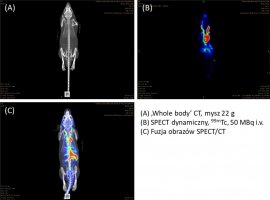 Przykładowe obrazy uzyskane na skanerze SPECT/CT