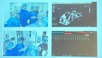 XVII Konferencja Aktualności w Kardiologii Inwazyjnej 2025 XVII Konferencja Aktualności w Kardiologii Inwazyjnej 2025
