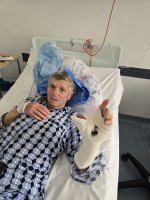 Lekarze z USK pomogli pacjentowi z Ostrowa Wielkopolskiego po ciężkim urazie dłoni Lekarze z USK pomogli pacjentowi z Ostrowa Wielkopolskiego po ciężkim urazie dłoni