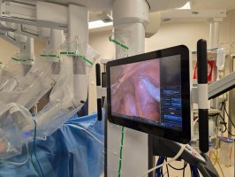 Pierwsze operacje z wykorzystaniem da Vinci w USK Pierwsze operacje z wykorzystaniem da Vinci w USK