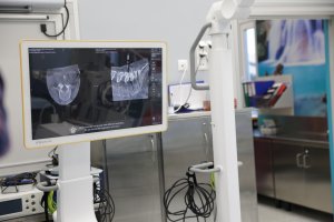 Ultranowoczesne systemy robotyczne w Klinice Neurochirurgii USK ze środków z KPO