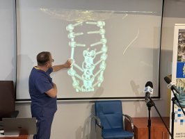 Lekarze z USK uratowali pacjenta z ciężkim urazem kręgosłupa szyjnego