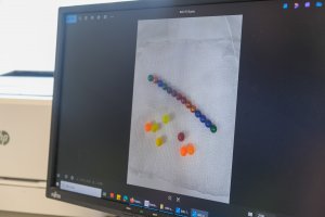 Małe przedmioty, wielkie zagrożenie. Lekarze z UDSK z apelem do rodziców Małe przedmioty, wielkie zagrożenie. Lekarze z UDSK z apelem do rodziców