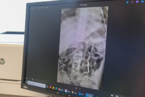 Małe przedmioty, wielkie zagrożenie. Lekarze z UDSK z apelem do rodziców Małe przedmioty, wielkie zagrożenie. Lekarze z UDSK z apelem do rodziców