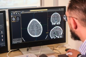 Bajkowa modernizacja w Zakładzie Radiologii UDSK Bajkowa modernizacja w Zakładzie Radiologii UDSK