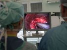 Kliniki neurochirurgii i otolaryngologii w uznaniu osiągnięć otrzymały grant rozwojowy - prawie 2 mln zł - na rozwój technik endoskopowych
