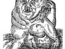 Foetus monstrosus, którego sekcję przeprowadził w 1613 roku J. Oelhaf