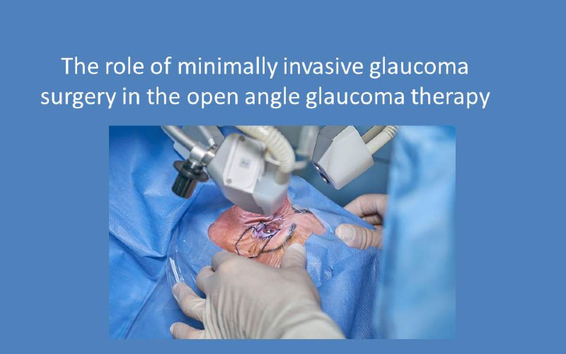Odnośnik: The role of minimally invasive glaucoma surgery in the open angle glaucoma therapy