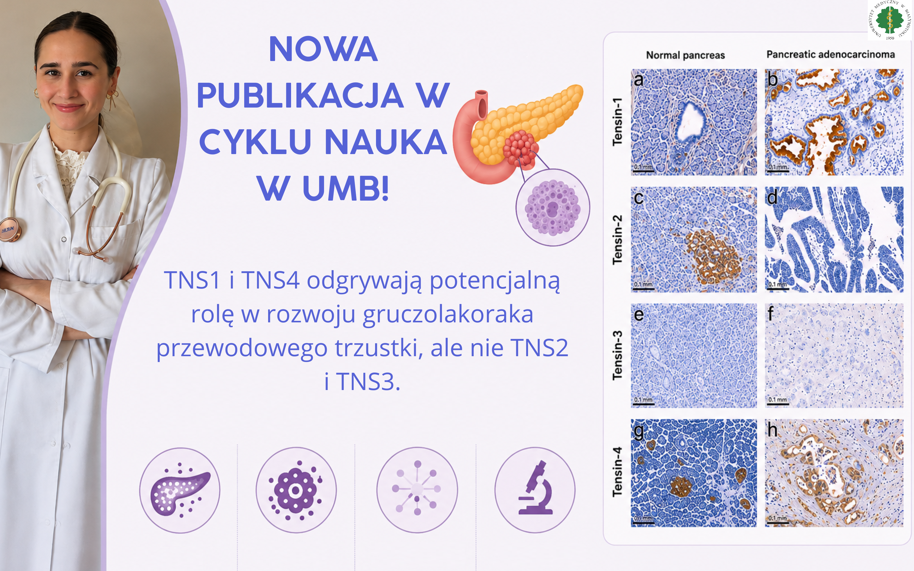 Odnośnik: W poszukiwaniu biomarkerów raka trzustki.
